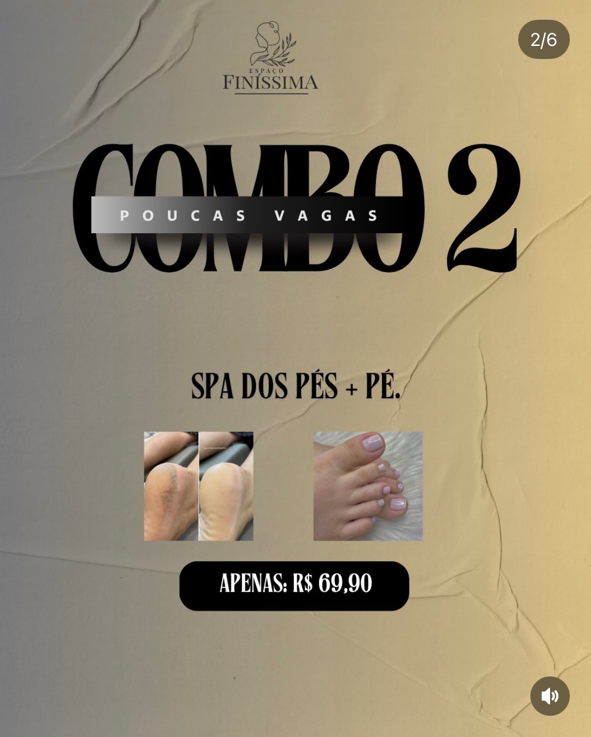Combo página 1